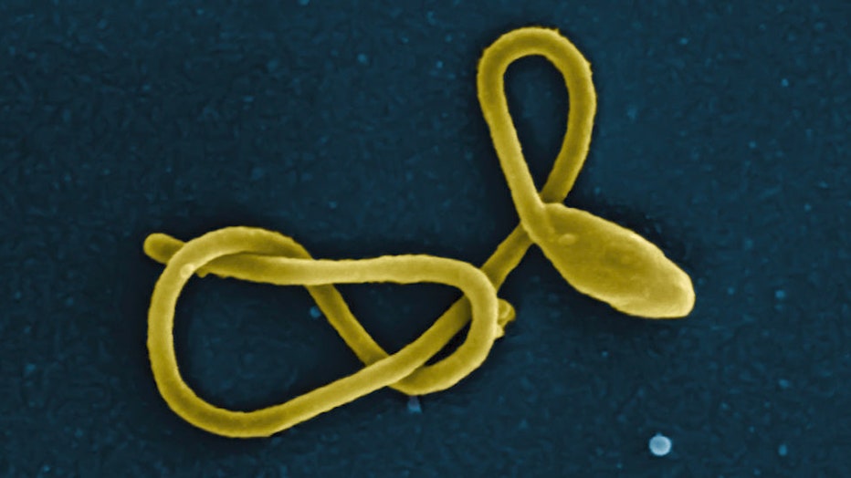 Ebola virus1
