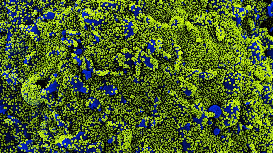 NIH_SARSCOV2_coronavirus_infected_cells