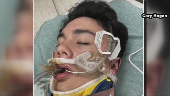 Family of Brazosport HS teen brutally beaten file $50 million lawsuit against teens involved, their parents
