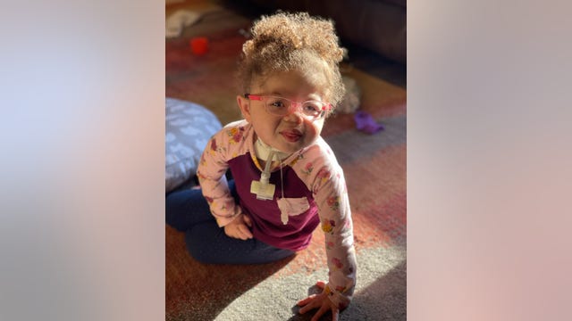 Child with rare, deadly condition has chance at life thanks to device developed at Georgia Tech