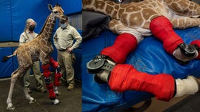 Baby giraffe at San Diego Zoo fitted with braces after being born with limb condition