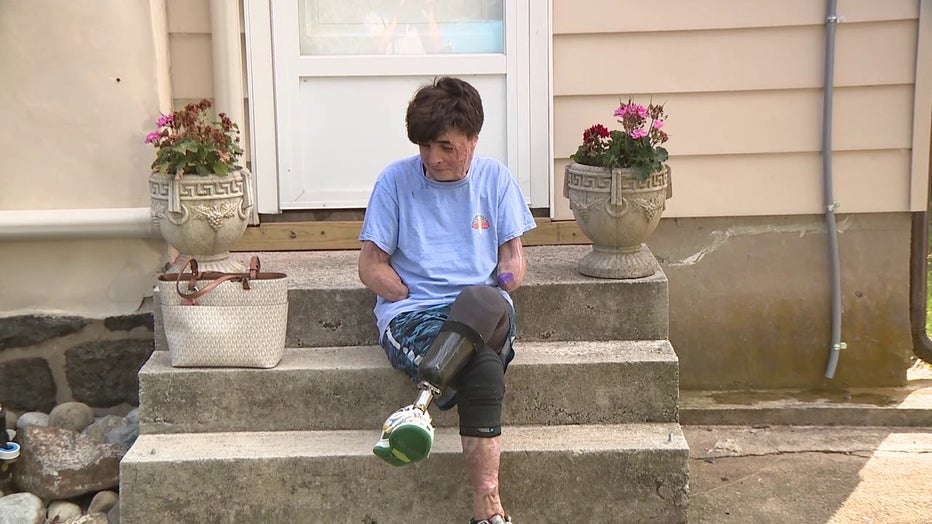 Chester County teen who survived being electrocuted receives life-changing home upgrade