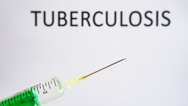 Person tests positive for tuberculosis at middle school in Delaware County, health officials say