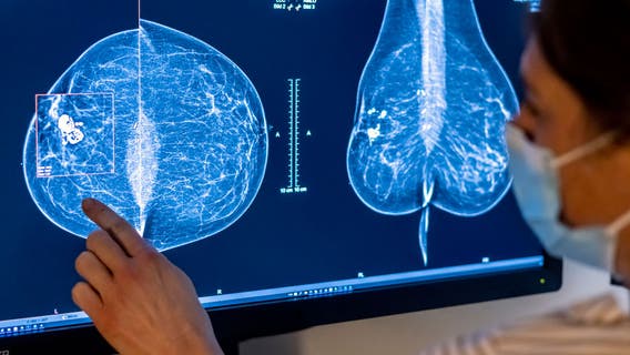 Pennsylvania aims to expand breast cancer screenings