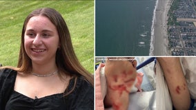 Teen surfer recalls shark attack off New Jersey coast: 'It pulled me down a little bit'