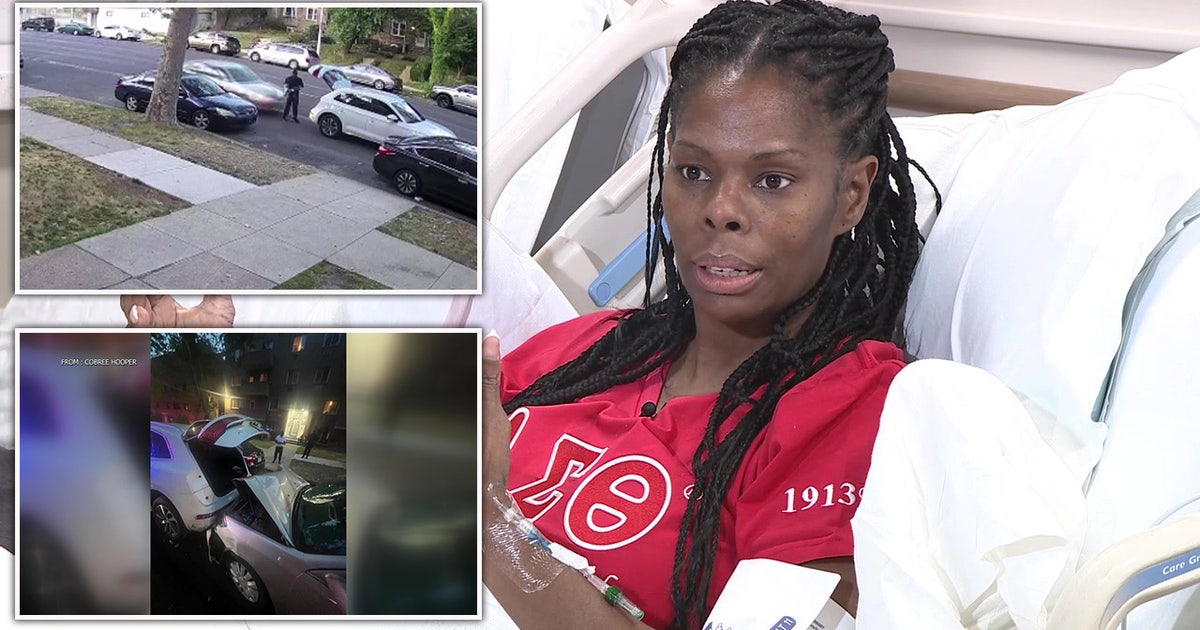 Woman who lost leg after being hit by suspected drunk driver ...