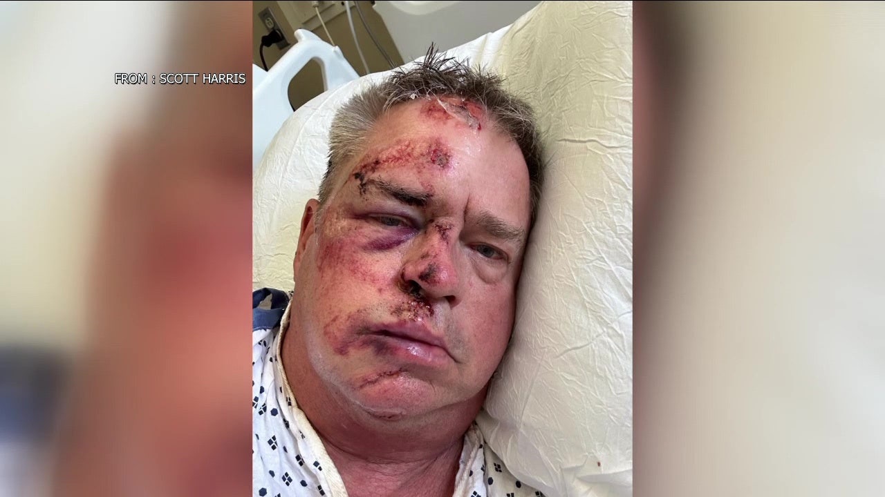 Retired Navy officer gets more than 100 stitches after assault while walking dog in Philadelphia
