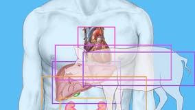 A pig's kidney worked normally in a donated human body for over a month, doctors say