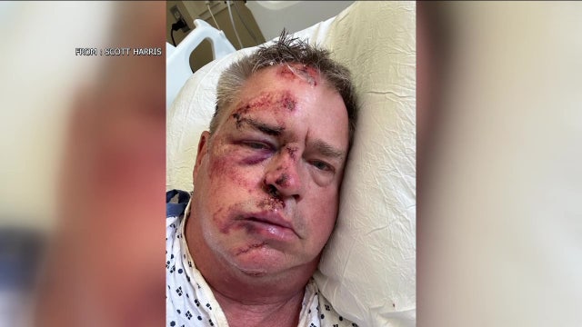 Retired Navy officer gets over 100 stitches after being mugged while walking dog in Philadelphia