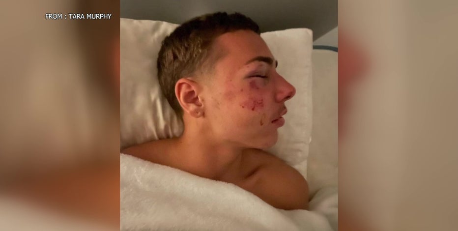 Delaware state trooper accused of assault; teen hospitalized with serious injuries