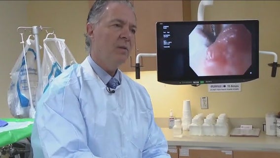 Suffer from heartburn, acid reflux? It could be tell-tale sign of esophageal cancer