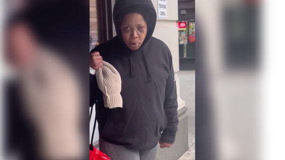 Woman headbutts, bites, steals wig during cigarette dispute in Center City: police