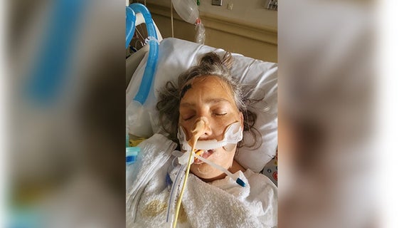 Police asking for help to identify woman hit by vehicle in North Philadelphia
