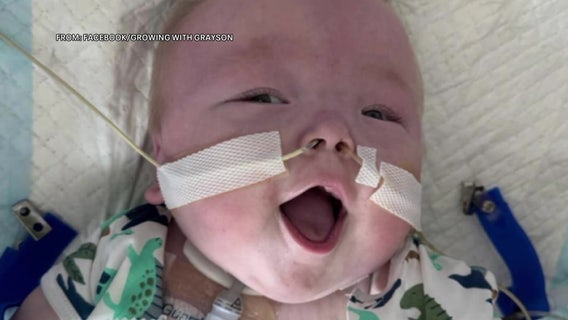 19-month-old New Jersey boy returns home after nearly 600 days in the hospital