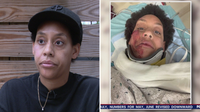 Driver sought after South Philly woman survives tragic hit-and-run: police