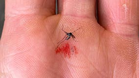 NJ resident infected with malaria, state officials investigate