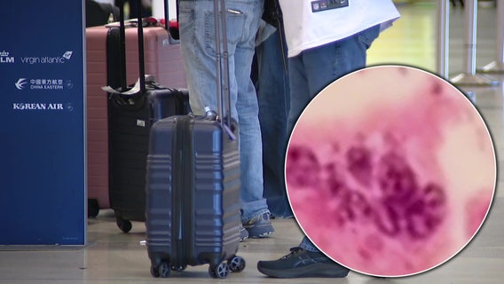 Officials warn of possible measles exposure at Philadelphia International Airport