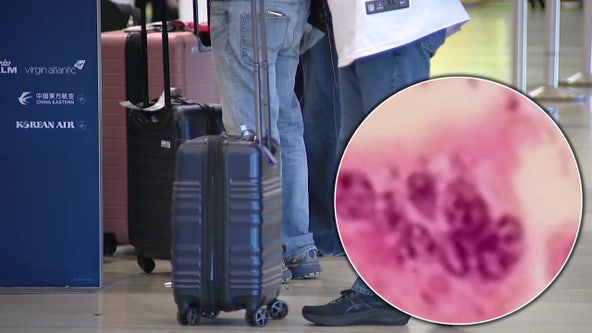 Officials warn of possible measles exposure at Philadelphia International Airport