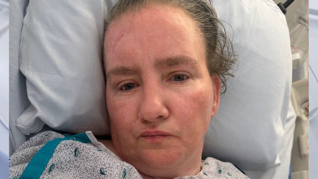 PPD look to ID woman hospitalized for 10 months after crash