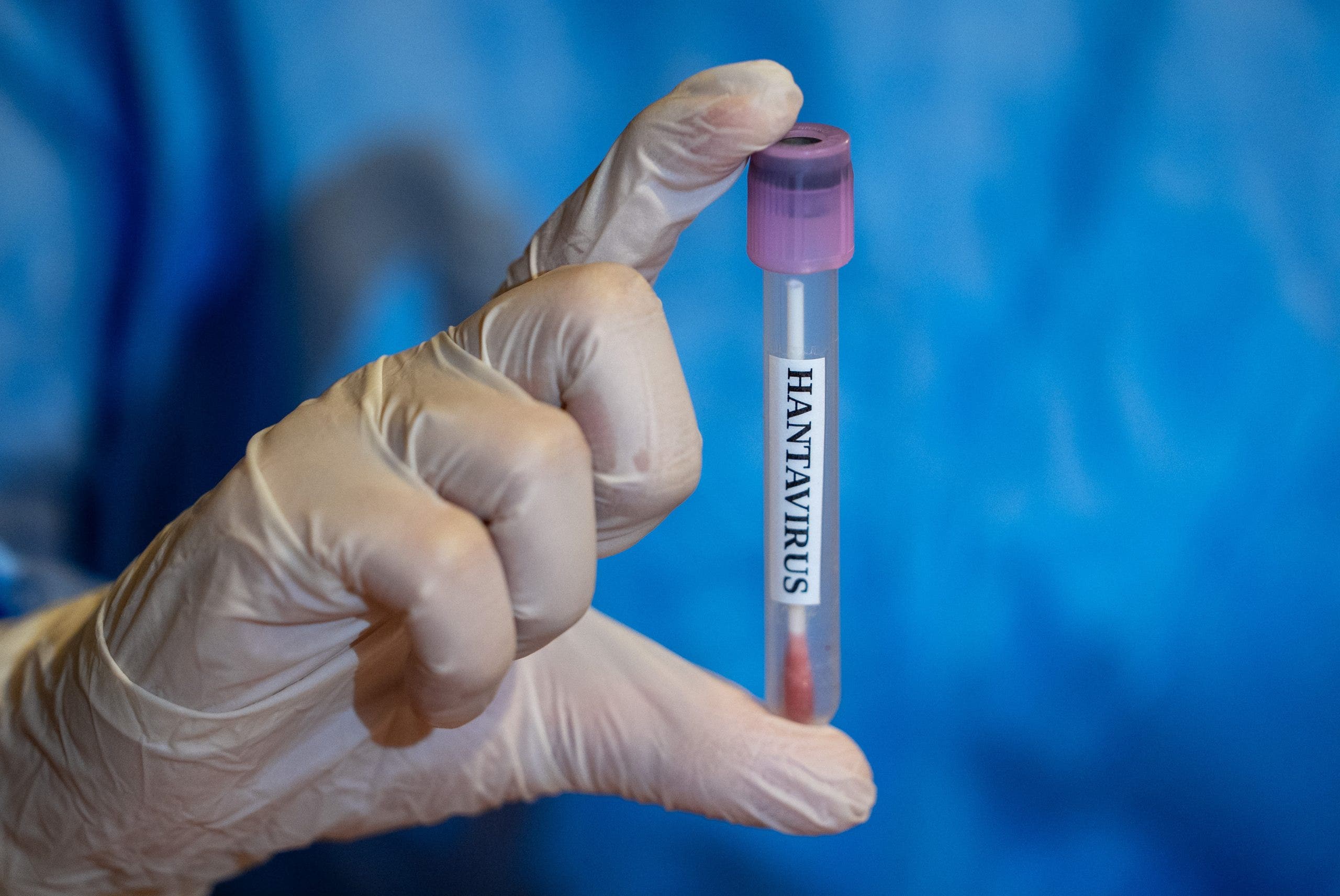 New Jersey hantavirus: 2 travelers being monitored after possible exposure abroad