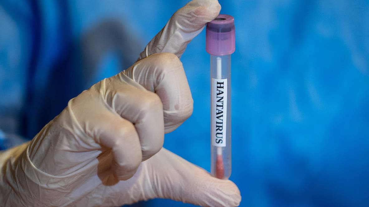 New Jersey hantavirus: 2 travelers being monitored after possible exposure abroad