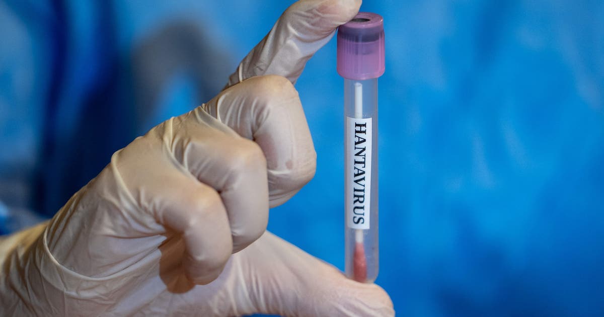 New Jersey hantavirus: 2 travelers being monitored after possible exposure abroad