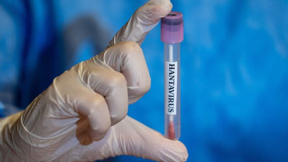 New Jersey hantavirus: 2 travelers being monitored after possible exposure abroad