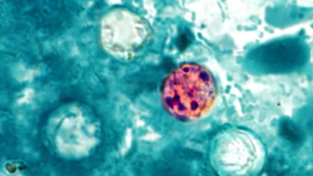 Pennsylvania added to cyclosporiasis outbreak list with at least 2 dozen cases