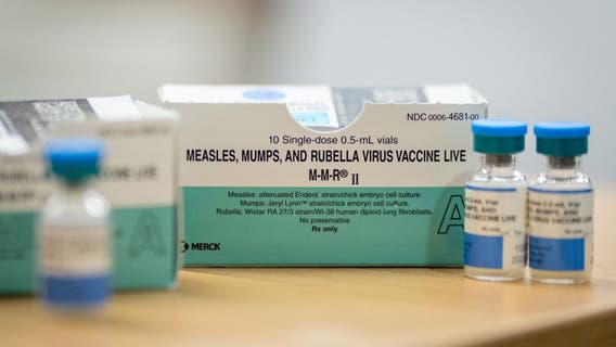 Congenital measles identified for first time in decades: What you need to know