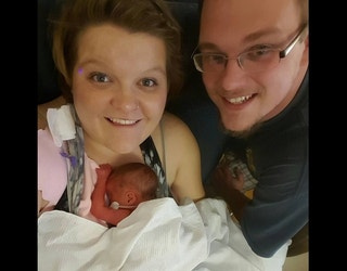 baby with genetic syndrome smiling after tongue reduction surgery