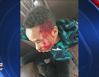 Ann_Arbor_boy_says_bully_beat_and_bloode_0_20170412211840