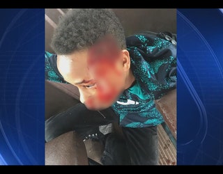 ann arbor boy bullied_1492032067328.JPG