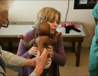Baby Born With Four Legs Two Spines Survives Complex Surgery In Illinois