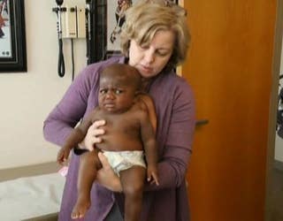 Baby Born With Four Legs Two Spines Survives Complex Surgery In Illinois