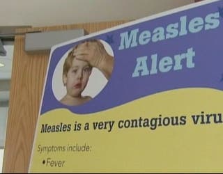 Additional Measles Cases Confirmed In Oakland County