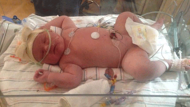 Woman gives birth to 'miracle' 15 lb. baby