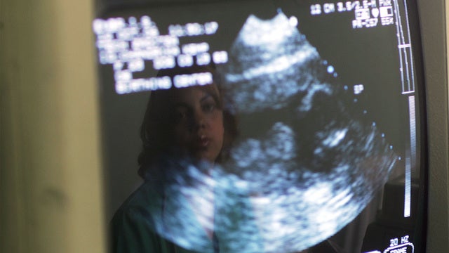 Ohio governor signs ban on abortion after 1st heartbeat