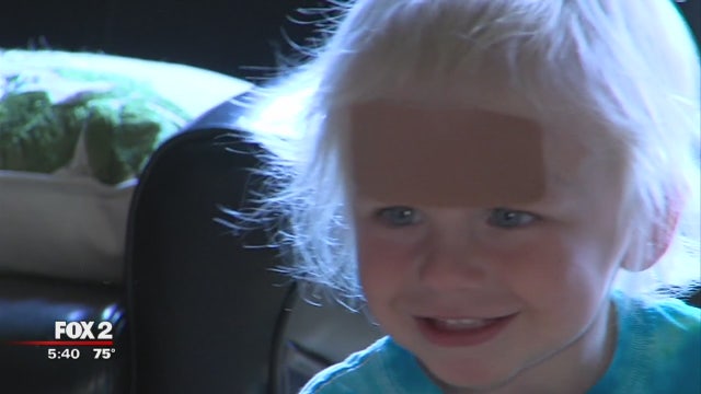 Should children get bandages or stitches?
