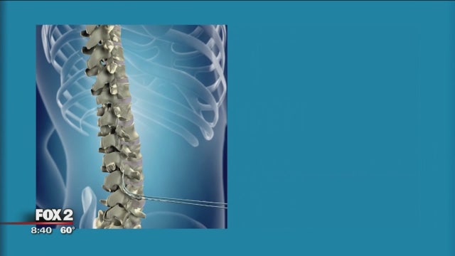 The Doctor Is In: Managing Chronic Pain