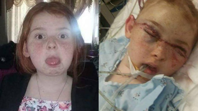 11-year-old speaks on recovering after carnival ride accident