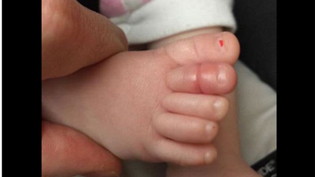 Warning from father about common baby problem