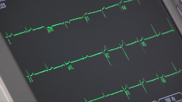 The connection between brain function, risk of heart attacks and strokes