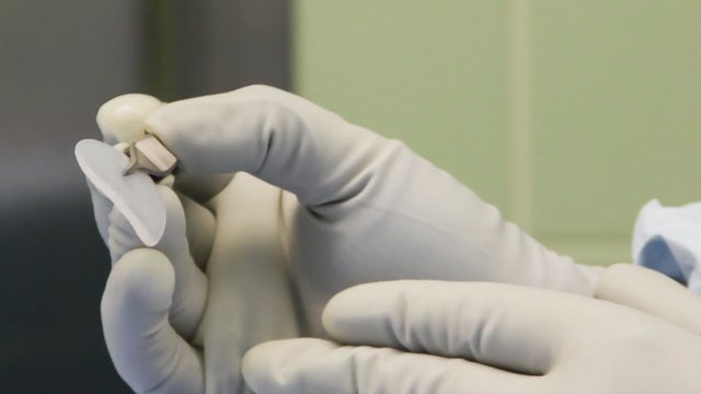 Doctors closer to growing cartilage in lab