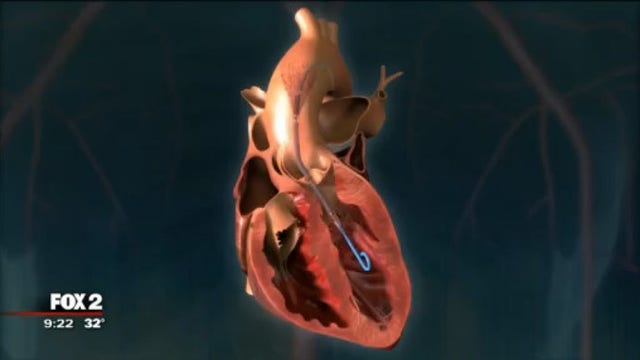 The Doctor Is In: Henry Ford & Heart Health