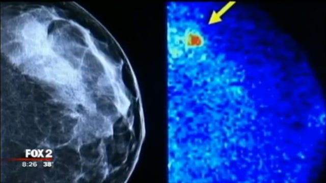 The Doctor Is In: Lung Cancer