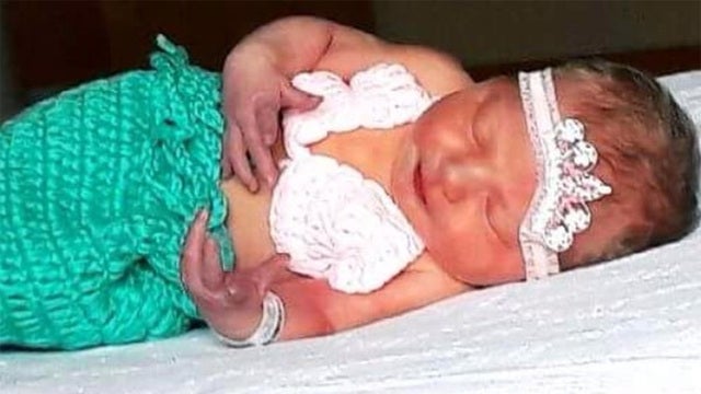 Newborn dies days after kiss transmits disease