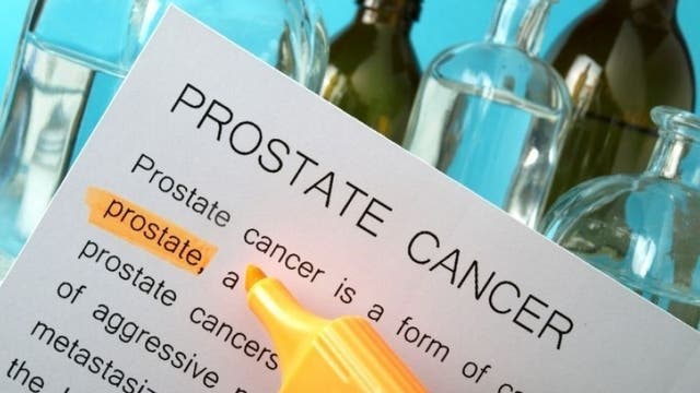 The Doctor Is In: Prostate Cancer Awareness
