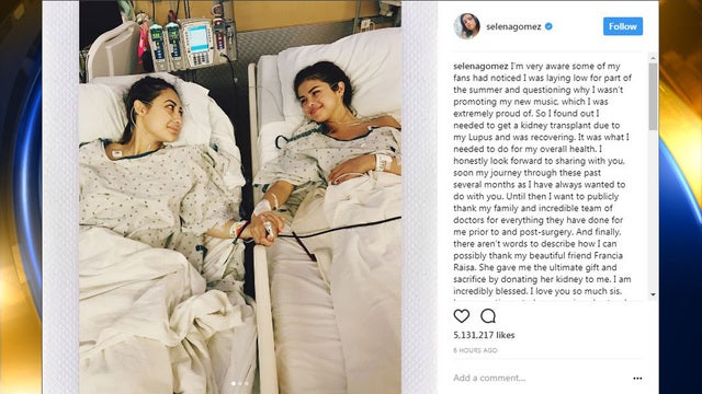 Selena Gomez undergoes kidney transplant due to her lupus