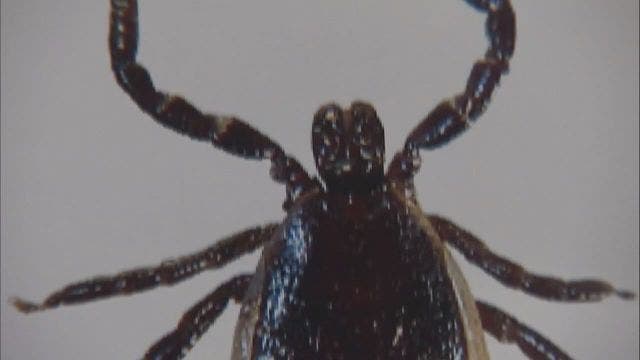Case of Rocky Mountain spotted fever in Michigan