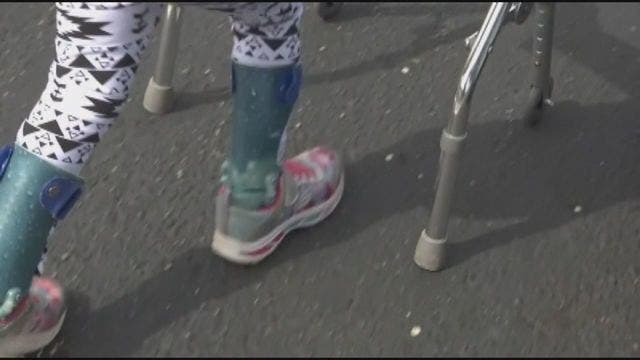 Second case of acute flaccid myelitis confirmed in Michigan